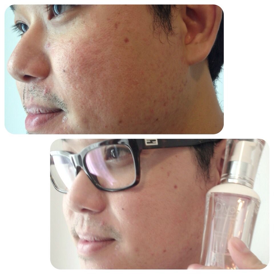 DIVOI DNA SERUM INNOVATIVE PRODUCTS BY USA FRANCE TAIWAN FORMULAR FACIAL LIFTING RECOVERY ANTI WRINKLE ACNE SKINCARE INNOVATIVE 