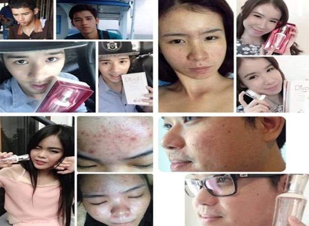 DIVOI DNA SERUM INNOVATIVE PRODUCTS BY USA FRANCE TAIWAN FORMULAR FACIAL LIFTING RECOVERY ANTI WRINKLE ACNE SKINCARE INNOVATIVE 