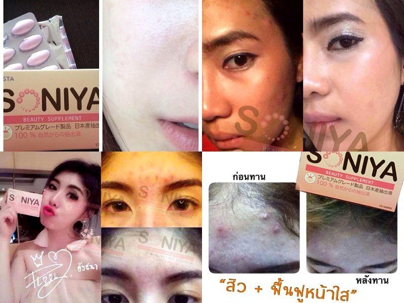 KISTA SONIYA BEAUTY SUPPLEMENT ANTI-ACNE PORES