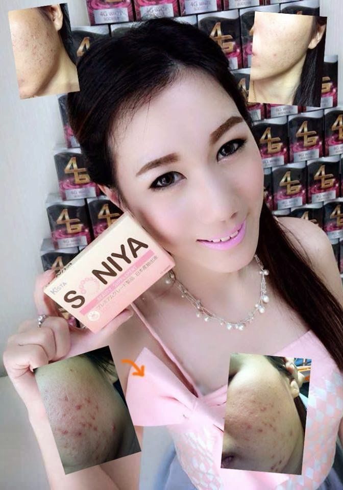 KISTA SONIYA BEAUTY SUPPLEMENT ANTI-ACNE PORES