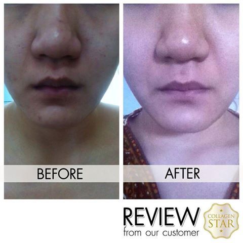 Collagen Star Strawberry Milk Tablet Collagen 8000mg 30 Sachets 300 Tablets . Reinvented The Collagen. First In The Form Of Pellet 8,000 Mg. 