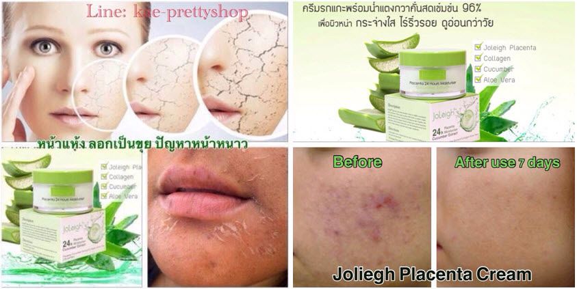 GC 40000 NANO GLUTATHIONE 40,000mg. JAPAN EXPERT Antioxidant For Rejuvenating Skin Whitening Skin Innovative Technology Anti Aging (France) Premium Quality Products Fast Result